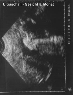 US-Baby03