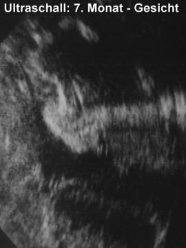 US-Baby04