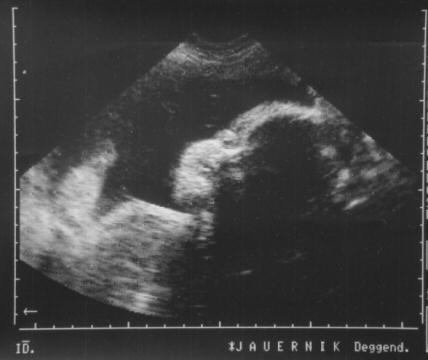 US-Baby06