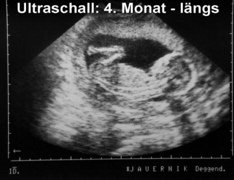 US-Baby09