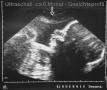 US-Baby01