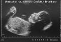 US-Baby02