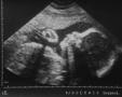 US-Baby07